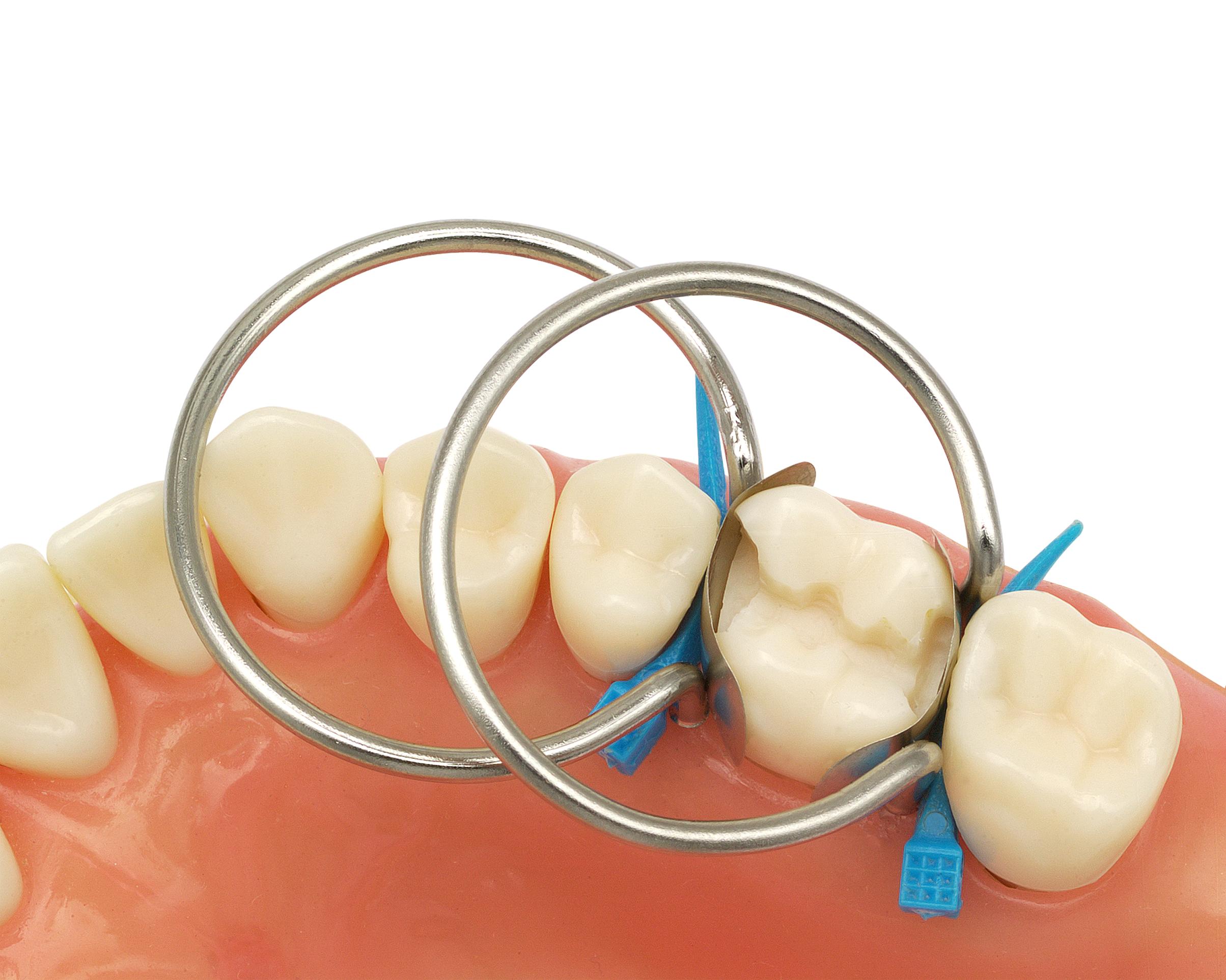 Ｐｅｒｉｏｄｏｎｔｉｃｓ ２ Composi-Tight® Original G-Rings